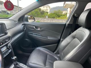 HYUNDAI Kona usata 27